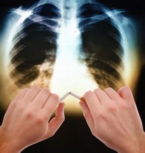 Enfisema pulmonar y cáncer de pulmón
