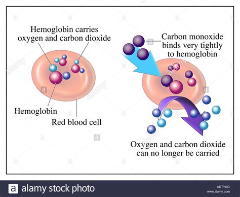 Enlace de monóxido de carbono con la hemoglobina Foto ...