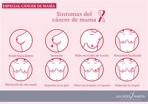 Especial cáncer de mama: la prevención, tu mejor aliada ...