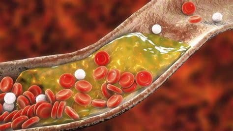 Espirulina: ¿Es eficaz contra el colesterol?