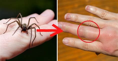 Estas son las arañas más venenosas del mundo y algunas se ...
