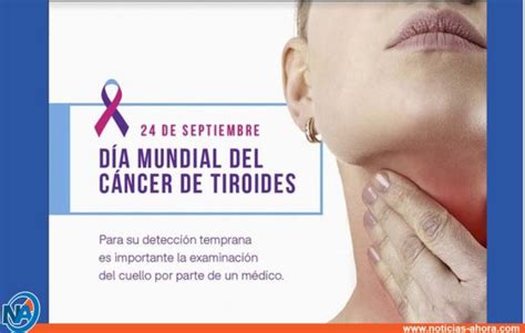 Este 24 de septiembre es el día mundial del cáncer de Tiroides