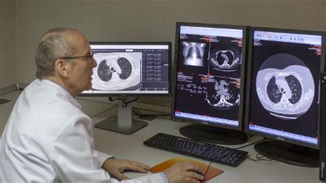 Este nuevo análisis de sangre detecta el cáncer de pulmón ...