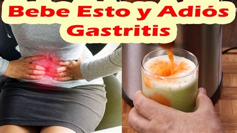 Esto Elimina La Gastritis y Úlceras Estomacales En 10 Días o Menos ...