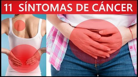 Estos Son Los Síntomas De Cáncer Mas Comunes, En su Etapa ...