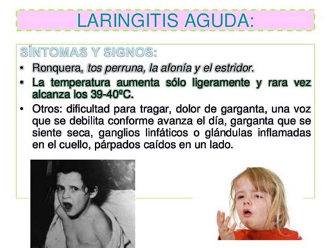 Expo laringitis aguda