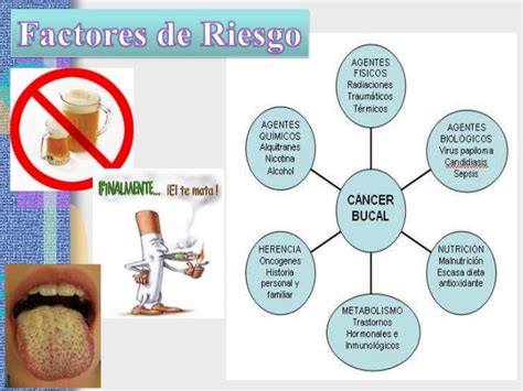 Exposicion patologia iii unidad cancer oral 1