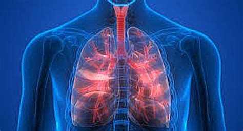 Fibrosis pulmonar: ¿Cuánto tiempo puede vivir una persona ...