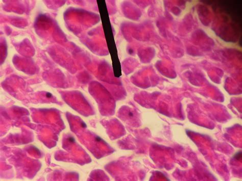 File:Acinar cells.JPG   Wikipedia