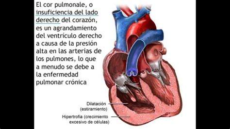 FISIOPATOLOGÍA CARDIOCIRCULATORIA  Patología cardíaca y valvulopatías ...