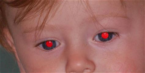 Fix Red Eyes: Eliminar ojos rojos de fotografias en forma ...