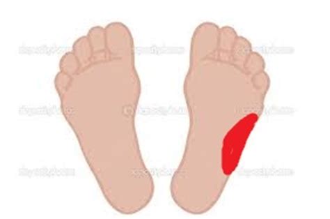 Foot pain from running outside edge of foot
