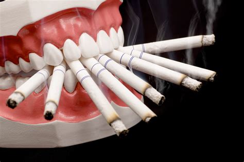 Fumar es un factor de riesgo ante el CÁNCER oral   Directorio Odontológico