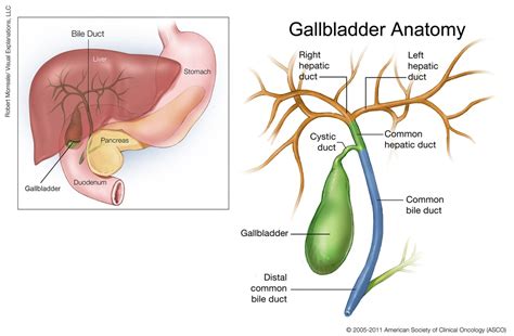 Gallbladder   GALLSTONES