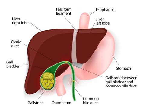 Gallbladder Inflammation Symptoms: Signs, Duration ...