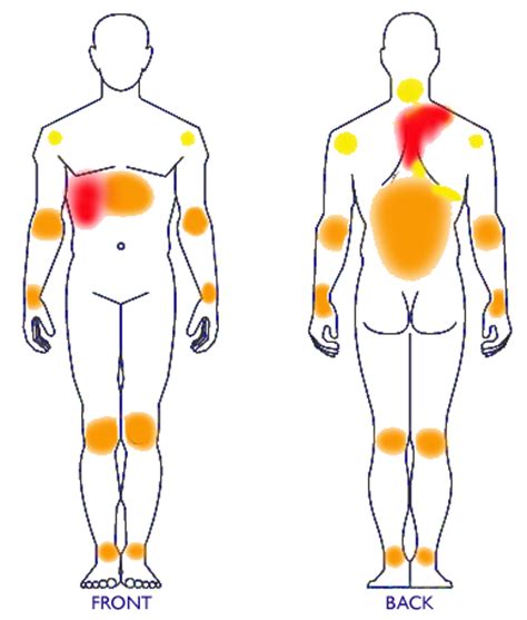 Gallbladder Symptoms | Gallbladder Attack in Canada & the USA!