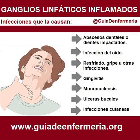 GANGLIO LINFÁTICO INFLAMADO   GUÍA DE ENFERMERÍA