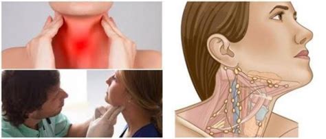 Ganglios Inflamados en el Cuello: Características, Causas, Síntomas ...