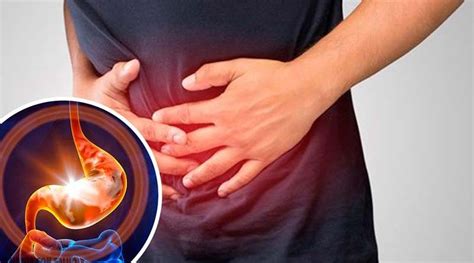 Gastritis, inflamación aguda o crónica de la mucosa estomacal | Soy ...