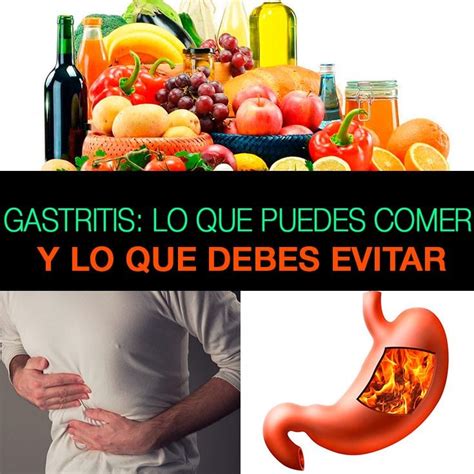 Gastritis: lo que puedes comer y lo que debes evitar | La Guía de las ...