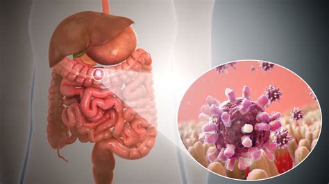 Gastroenteritis: síntomas, causas, tratamiento y prevención