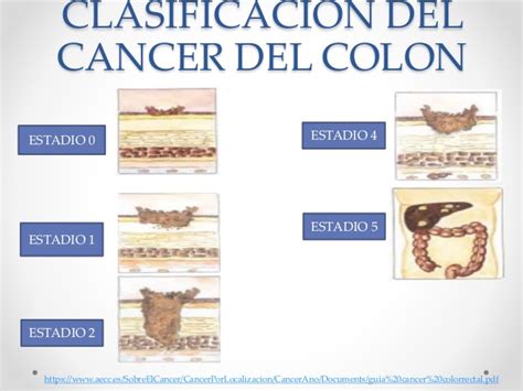 genetica cancer de colon