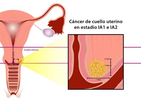 Ginecología y Diagnóstico Prenatal | Equipo Dr.Chacón ...