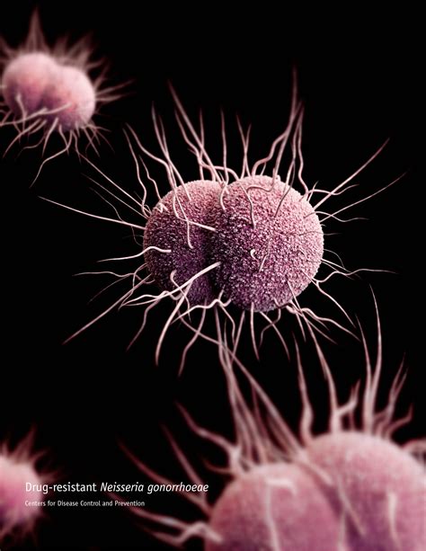 Gonorrhea may soon become resistant to all antibiotics