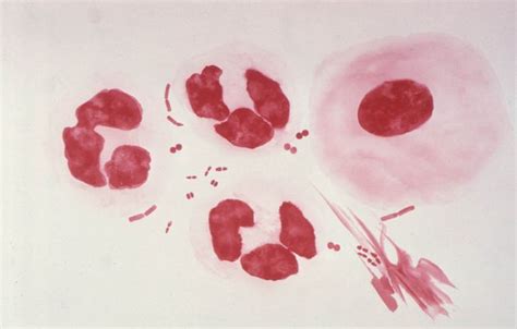 Gonorrhea Neisseria gonorrhoeae free images, public domain ...