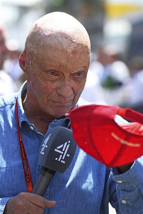 GP Alemania F1 2016: 40 años del accidente de Niki Lauda ...