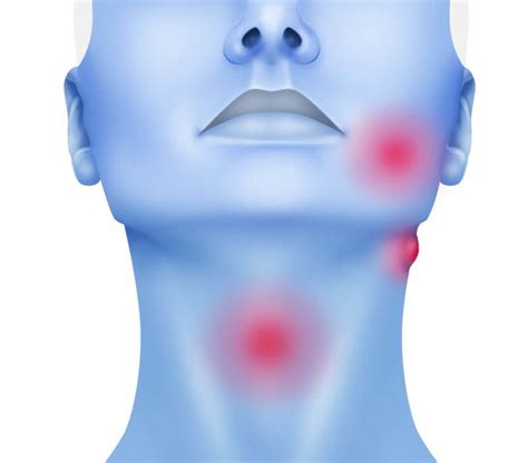 Head and Neck Tumours   Oral and Maxillofacial Surgery