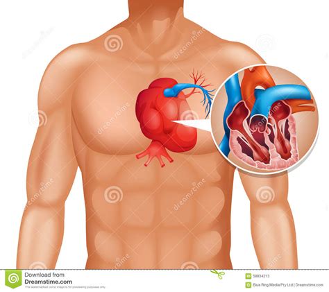 Heart cancer in human stock vector. Illustration of ...