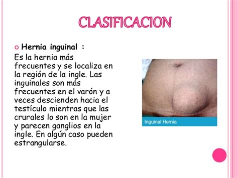 Hernia hiatal y abdominal