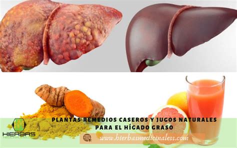 Hierbas medicinales para el hígado graso | Hierbasmedicinaless.com