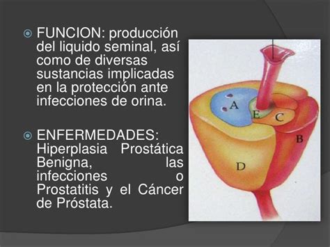 Hiperplasia de prostata