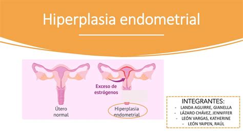 Hiperplasia endometrial | Apuntes de medicina | Medicina | uDocz