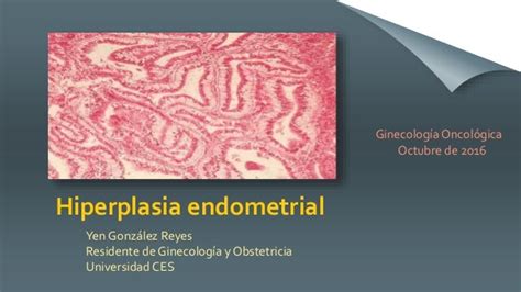 Hiperplasia endometrial