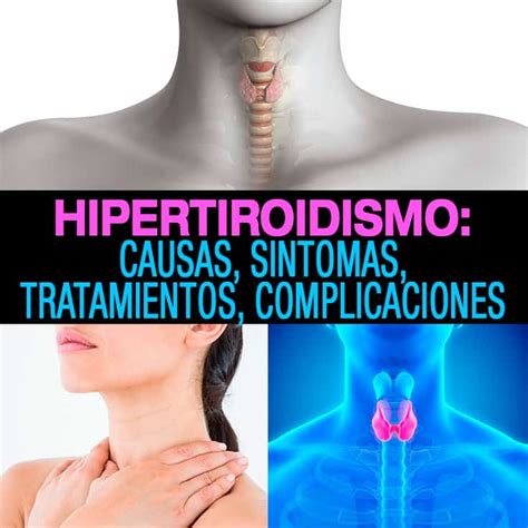 Hipertiroidismo: causas, síntomas, tratamientos y ...