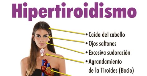 Hipertiroidismo   Escuelapedia   Recursos ...