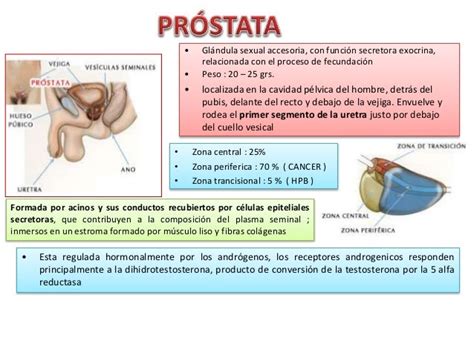 Hipertrofia benigna de próstata USP