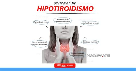 Hipotiroidismo, hierbas medicinales para los síntomas
