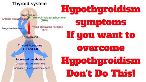 Hipotiroidismo Sintomas   SEONegativo.com