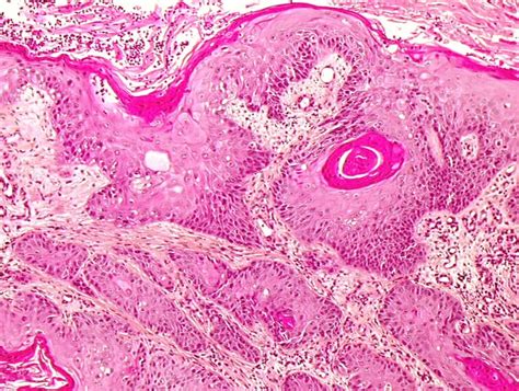 Histopathology of the uterine cervix   digital atlas