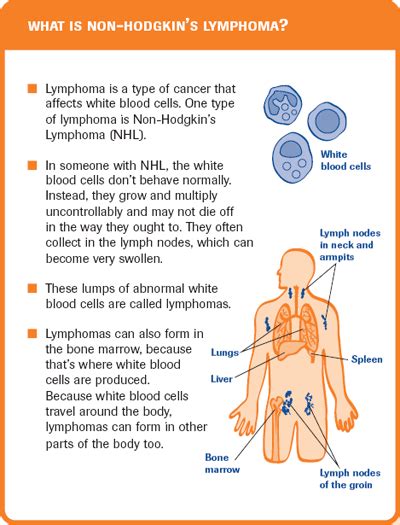 hodgkin s lymphoma stages | Quick reference cards   Non ...
