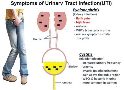 Home Remedies For  Urinary Tract Infection  | Womans Vibe