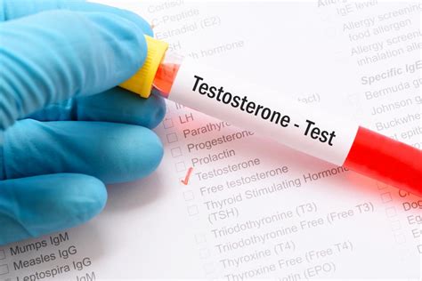 Homens com baixa testosterona menos propensos a ter câncer de próstata ...
