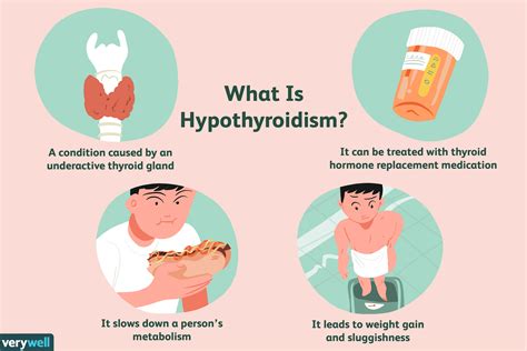 Hypothyroidism: Overview and More