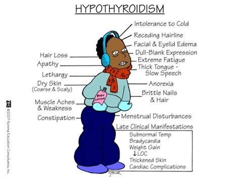 Hypothyroidism – Justin Groce – Medicine and Wellness