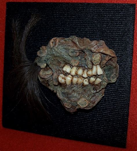 I own this amazing TeraToma Tumor | Oddities, Brooch, Cool stuff
