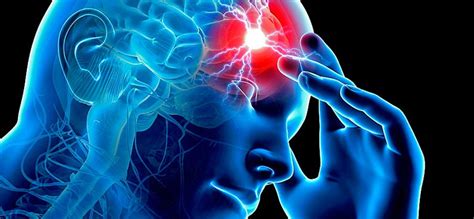 Ictus o infarto cerebral: los signos de alerta que salvan ...